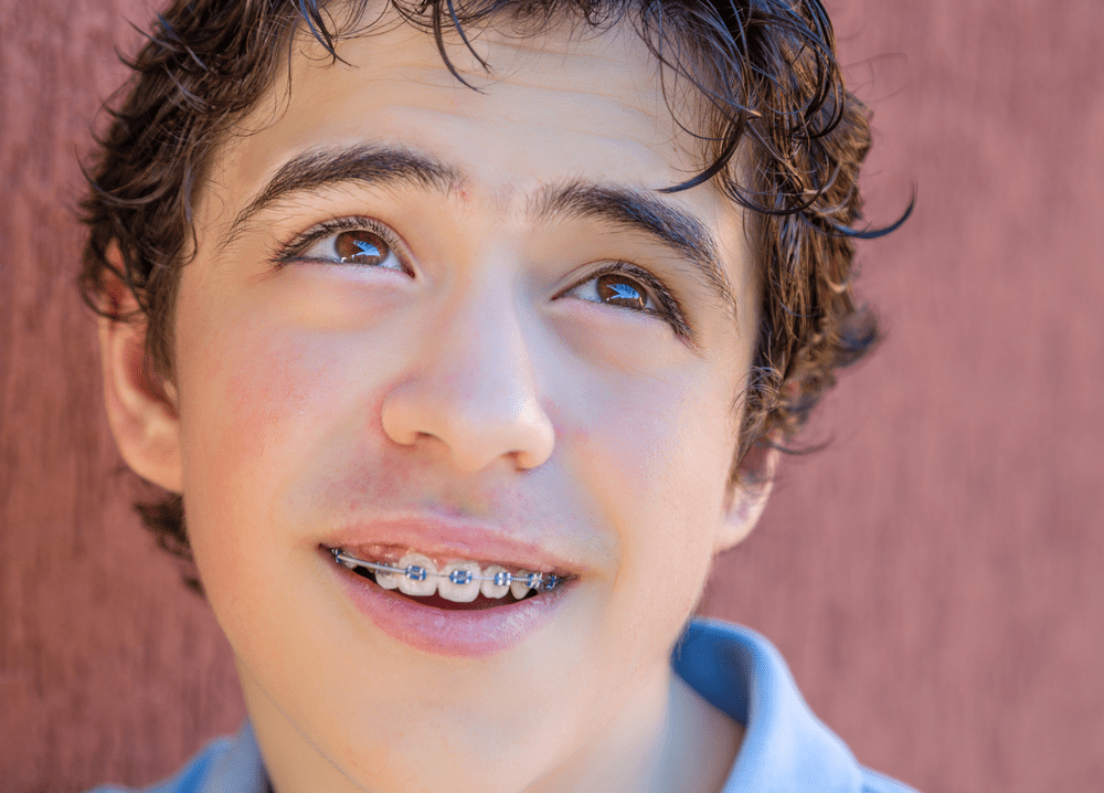 DIY-braces