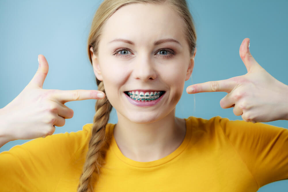 affordable-braces-invisalign